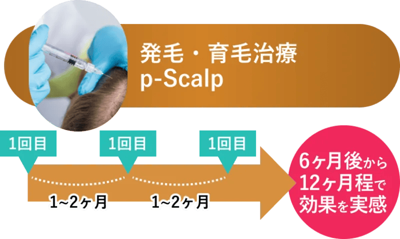 必要な回数が違う