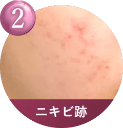 こんなお肌のお悩みに適しています