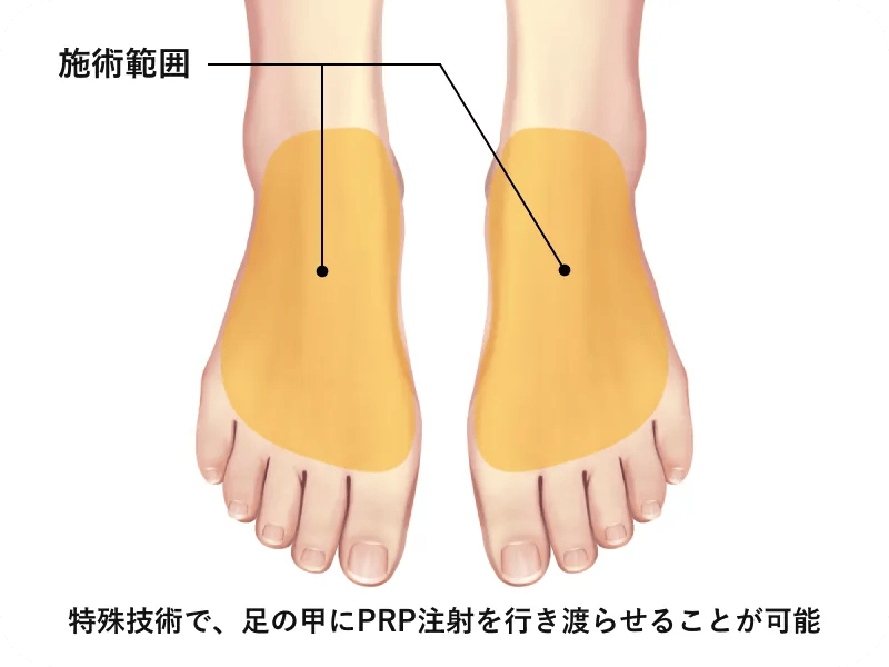 治療のメカニズム