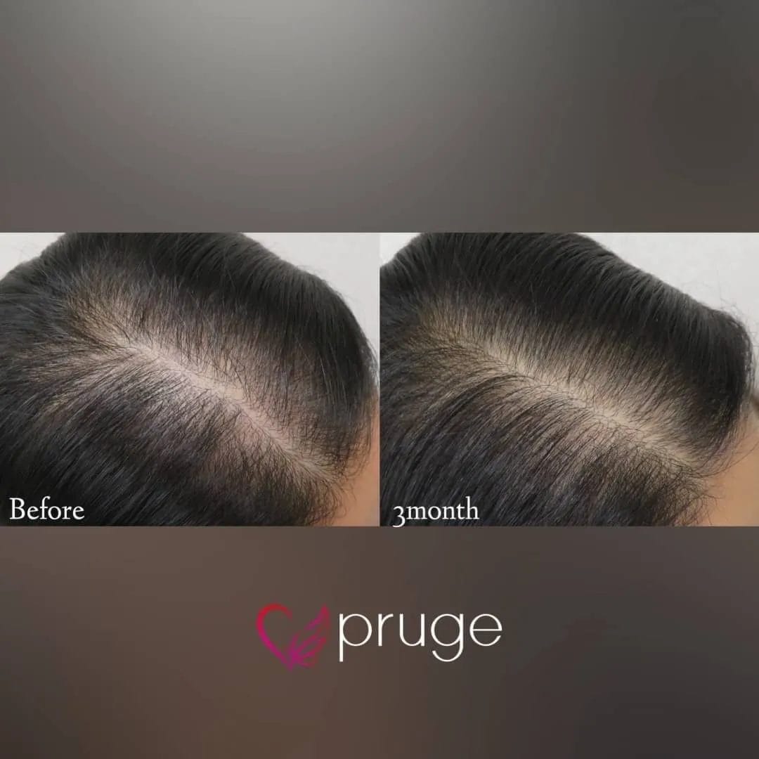 p-Scalp
